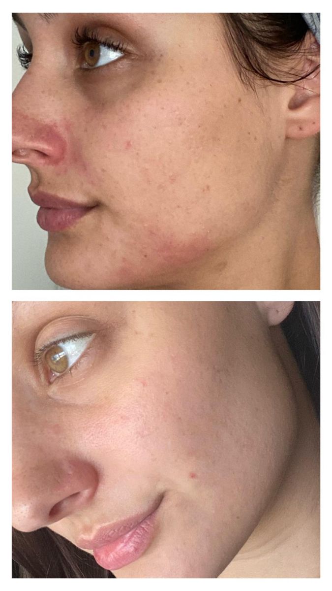 Crema Ultra Hidratante Aloe Vera · 480 cc