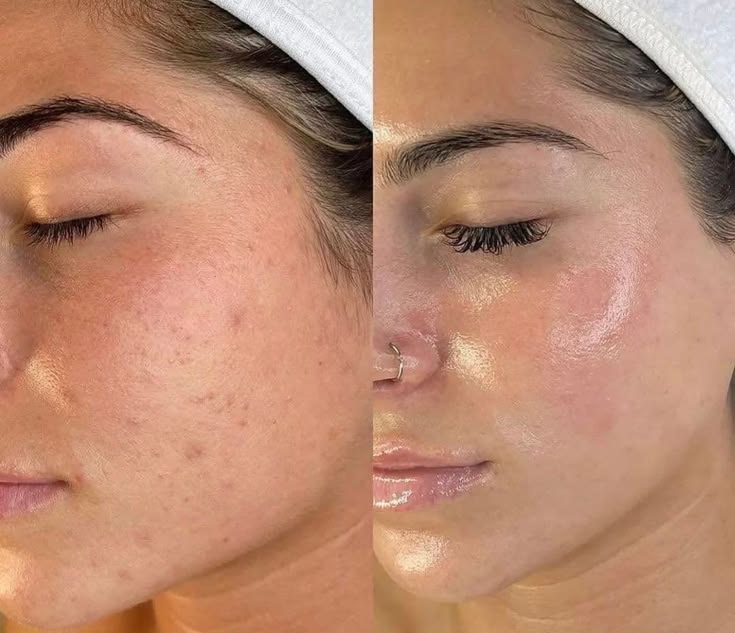 Crema Exfoliante Corporal · Pote